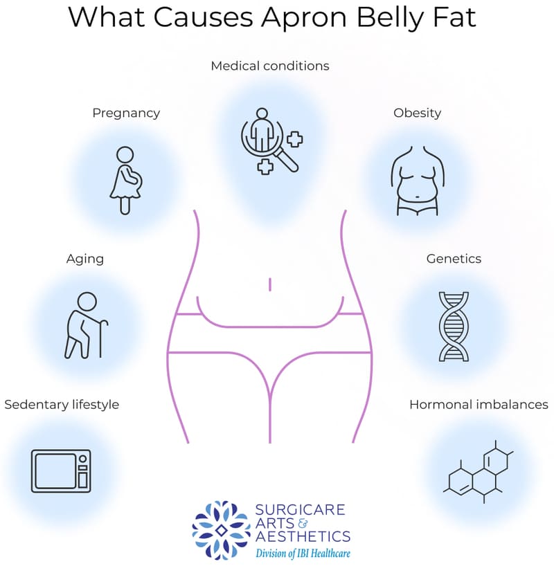 What is Apron belly? Look into its Causes and Solutions