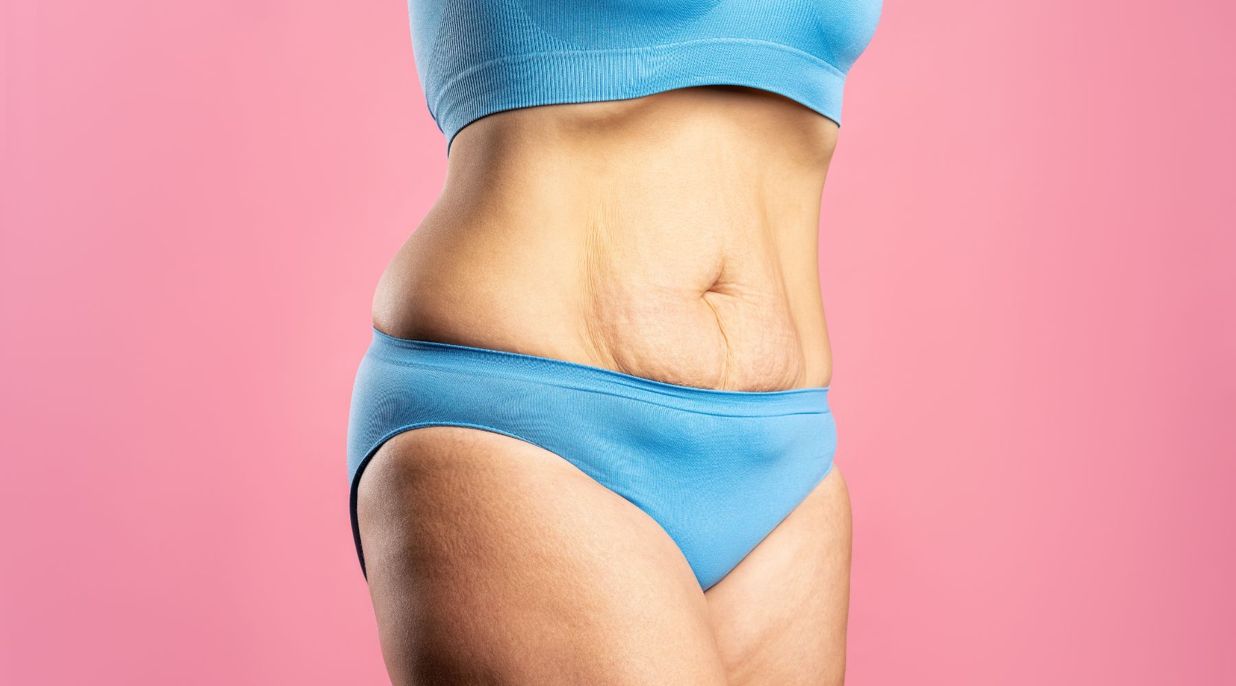 How to Get Rid of Hanging Belly Fat (Without Surgery)