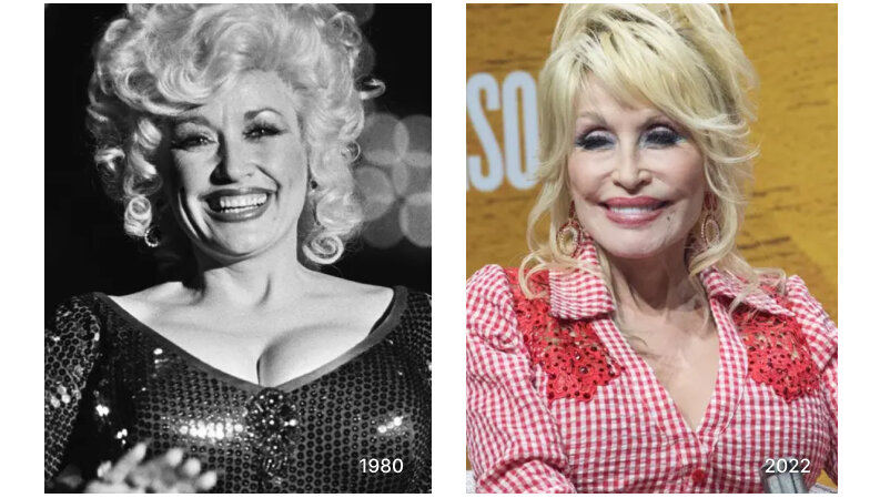 Dolly Parton got breast reduction surgery because her trademark 40DD  'Virginia Twins' were killing her