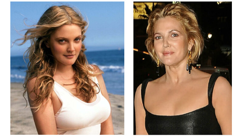 10 Celebrities Who Had Breast Reduction Surgery (+ Photos)